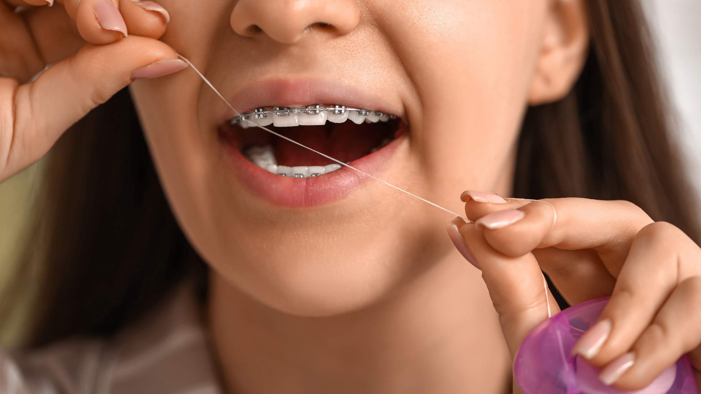 hilo dental con ortodoncia