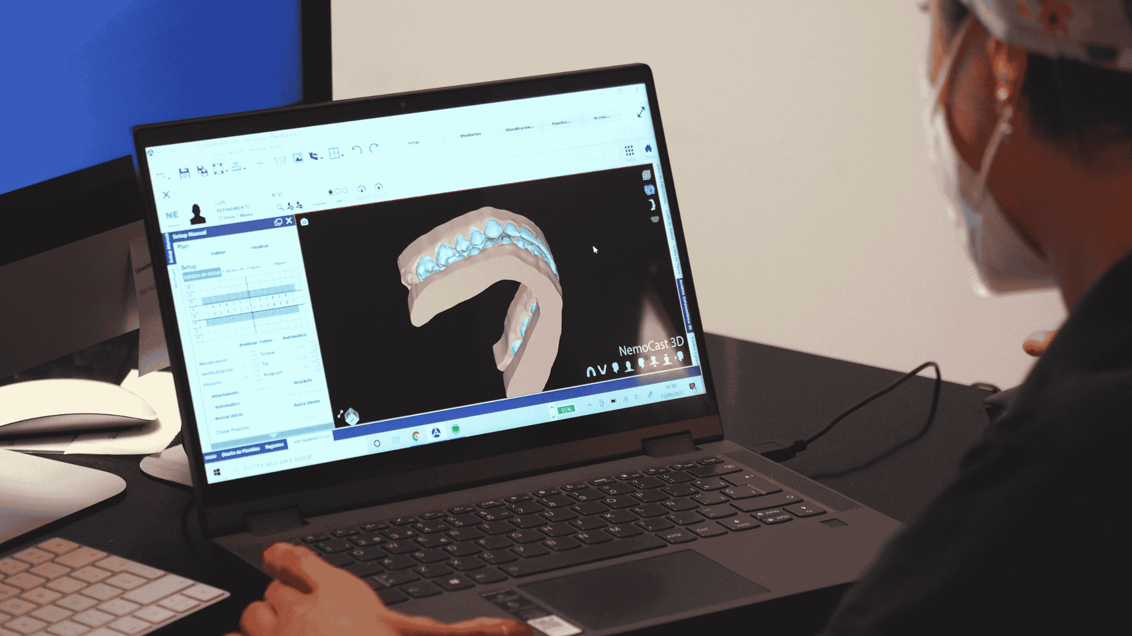 Dientes apiñados: causas y tratamientos recomendados