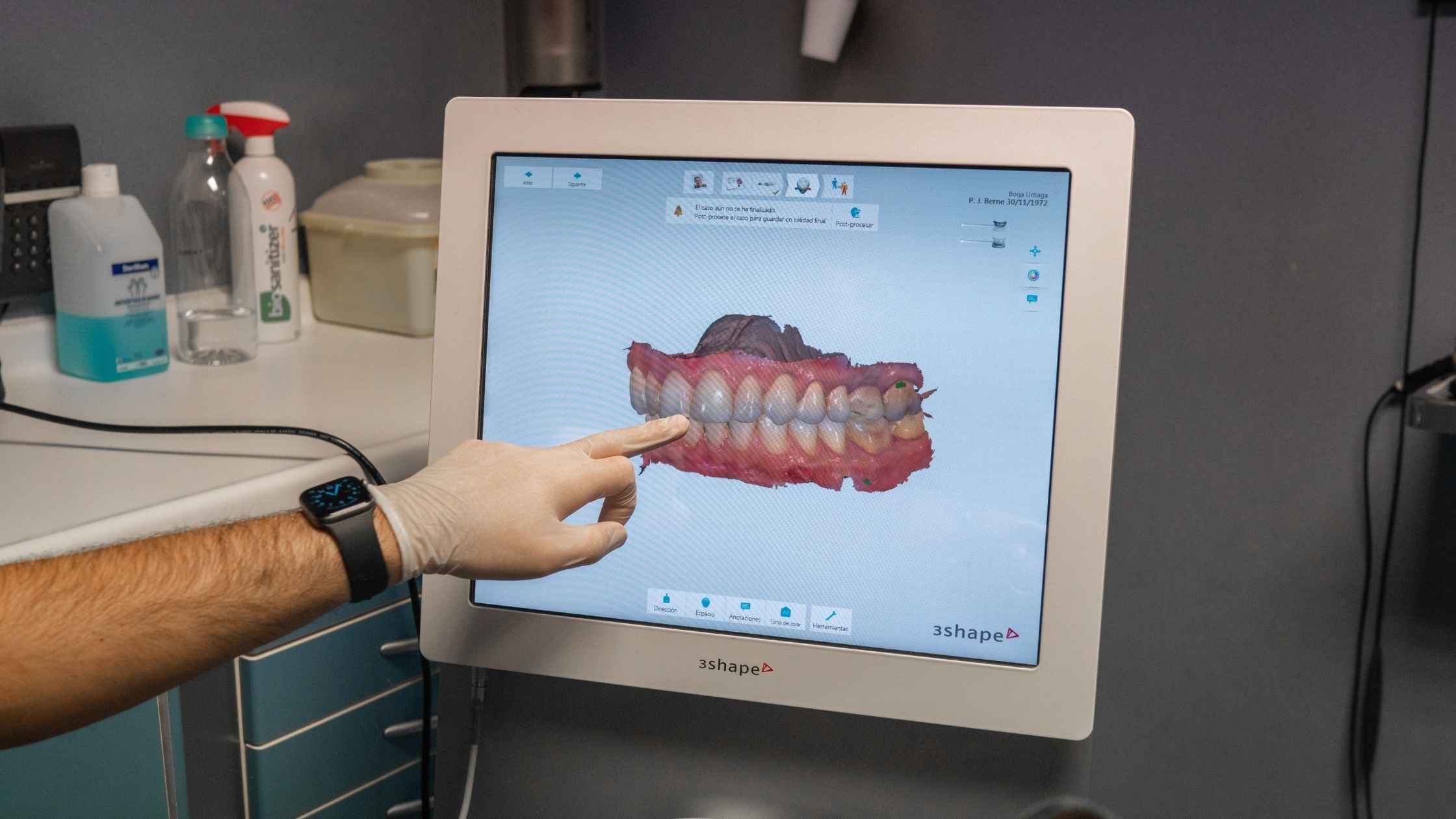 ortodoncia para un solo diente