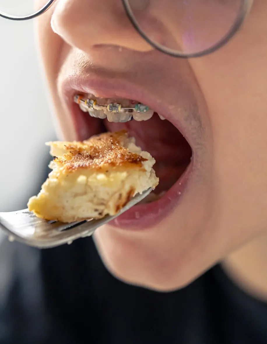 Persona comiendo con brackets